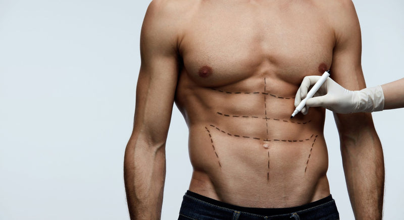 Why More Men Are Choosing Surgery - insidefitnessmag.com